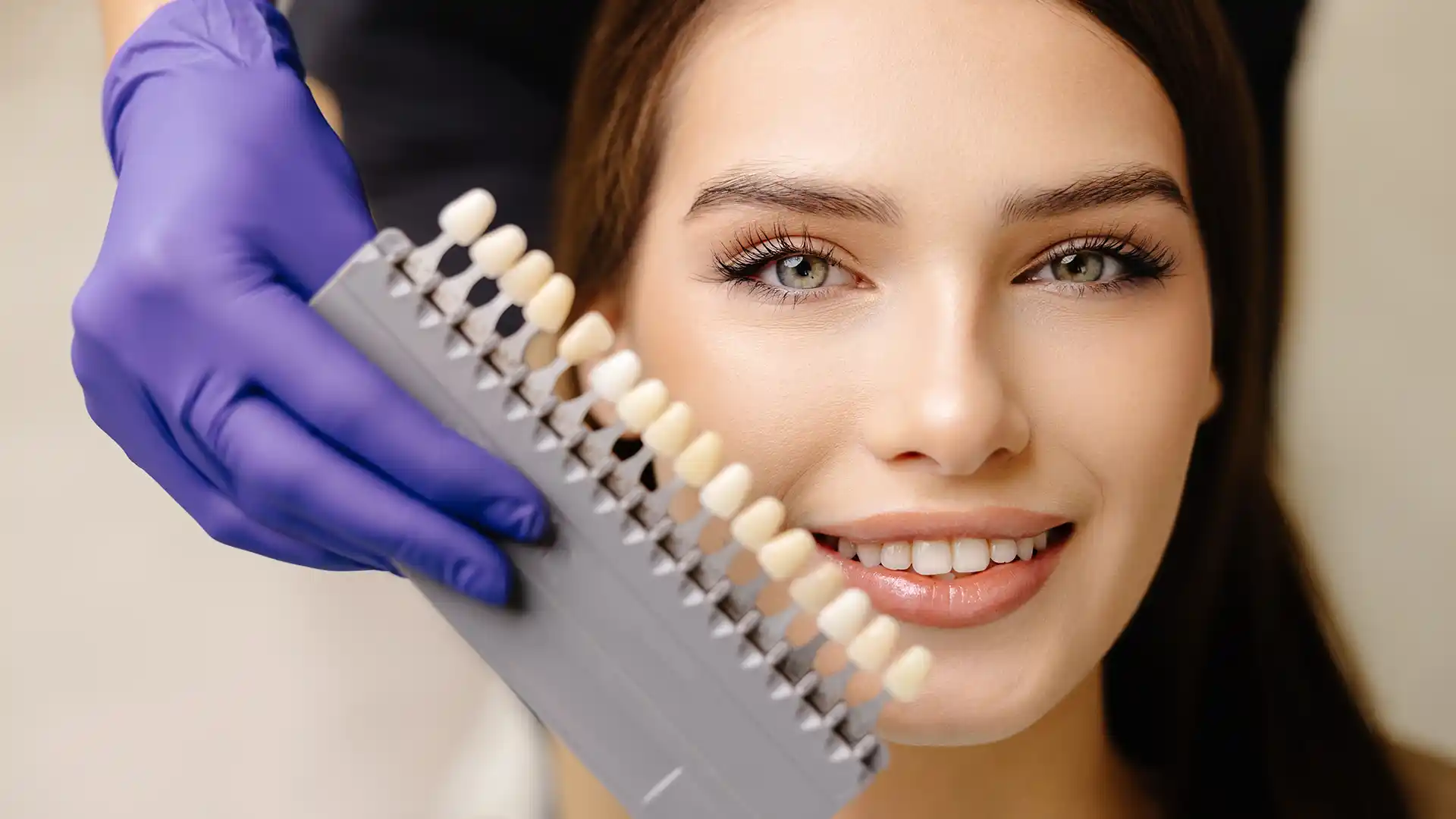 Faccette Dentali in Turchia